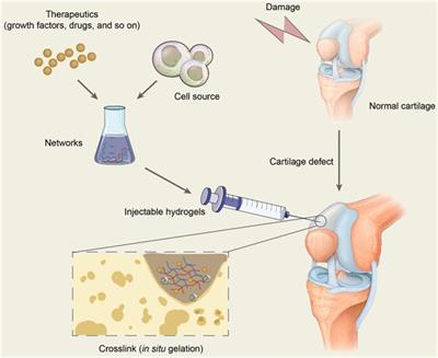 Advanced injectable hydrogels for cartilage tissue engineering